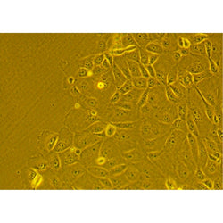 Human Primary Stomach Epithelial Cells