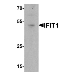 IFIT1 antibody