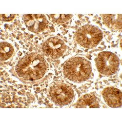 IFIT1 antibody
