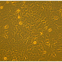 Monkey Bone Marrow Mesenchymal Stem Cells (MKMSC)