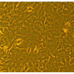 Cynomolgus Monkey Primary Ocular Choroid Fibroblasts
