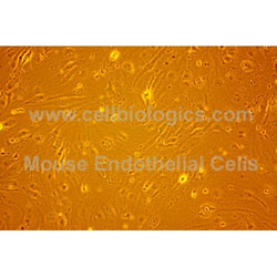Diabetic Mouse Artery Endothelial Cells