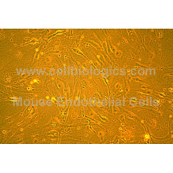 Diabetic Mouse Vein Endothelial Cells