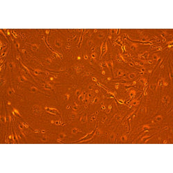 Diabetic Mouse Lung Microvascular Endothelial Cells