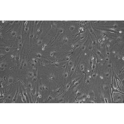 Diabetic Mouse Ovarian Microvascular Endothelial Cells