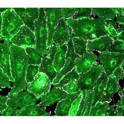 Diabetic Mouse Corneal Epithelial Cells