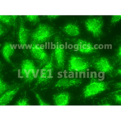 Human Primary Lymphatic Endothelial Cells