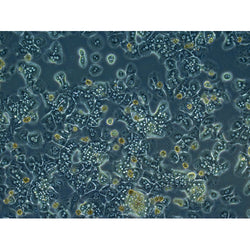 Diabetic Mouse Hepatocytes - Plateable
