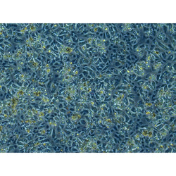Diabetic Mouse Liver Kuffer Cells
