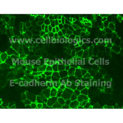 Aged Mouse Alveolar Epithelial Cells