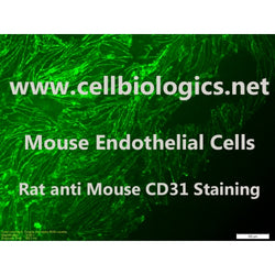 Diabetic Mouse Pulmonary Artery Endothelial Cells