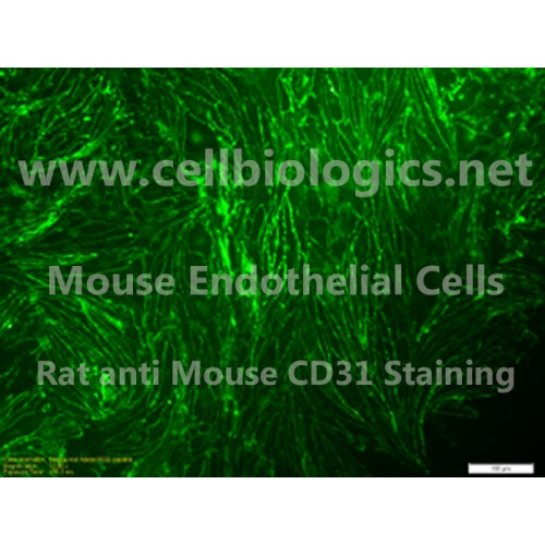 Toll-Like Receptor 4 Knockout (TLR4 KO) Mouse Primary Uterine Microvascular Endothelial Cells