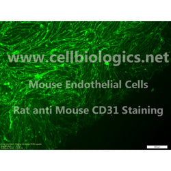 Diabetic Mouse Mammary Microvascular Endothelial Cells