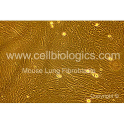 Diabetic Mouse Lung Fibroblasts