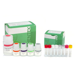 Mycobacteria DNA Extraction Kit MycoSHENTEK™