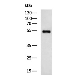 6×His Tag rabbit polyclonal antibody