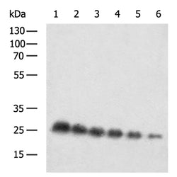 GFP rabbit polyclonal antibody
