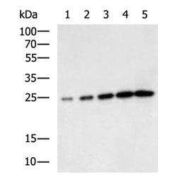 GST tag rabbit polyclonal antibody