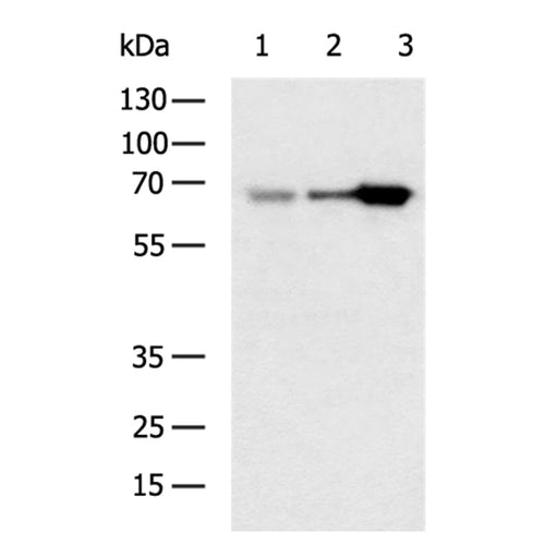 ALB rabbit polyclonal antibody