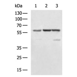 PKM rabbit polyclonal antibody