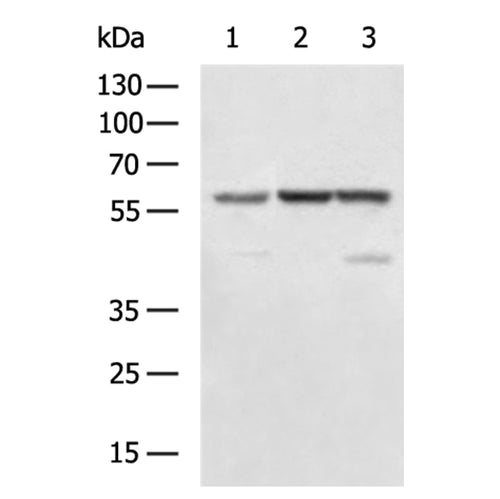 PKM rabbit polyclonal antibody
