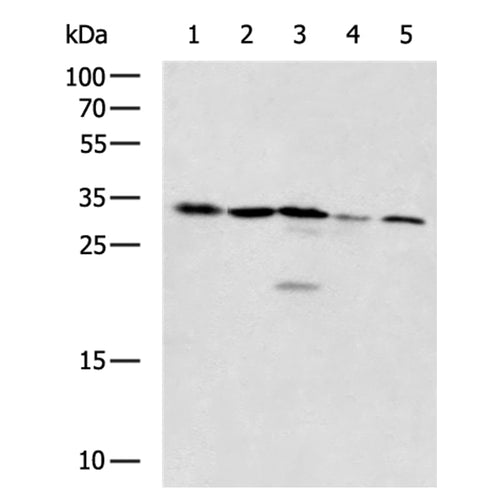 PCNA rabbit polyclonal antibody