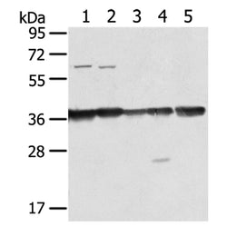 ANXA2 rabbit polyclonal antibody