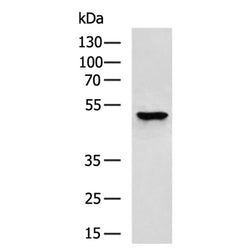 MMP13 rabbit polyclonal antibody