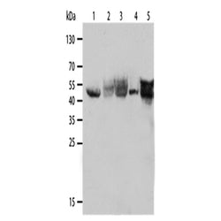 KRT19 rabbit polyclonal antibody