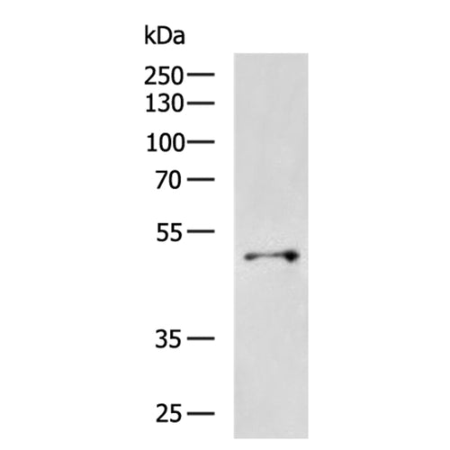 KRT17 rabbit polyclonal antibody