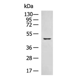 KRT23 rabbit polyclonal antibody