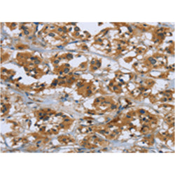 RAP1B rabbit polyclonal antibody