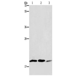 RAP1B rabbit polyclonal antibody
