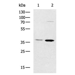 CTSL rabbit polyclonal antibody