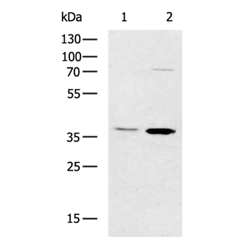 CTSL rabbit polyclonal antibody