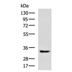 CLEC7A rabbit polyclonal antibody