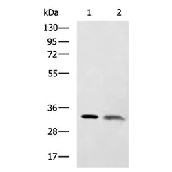 CDK5 rabbit polyclonal antibody
