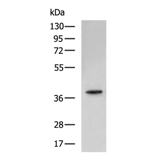 CDK6 rabbit polyclonal antibody