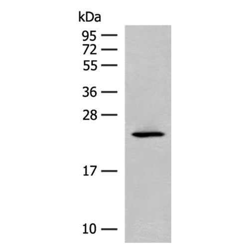 CDKN1A rabbit polyclonal antibody