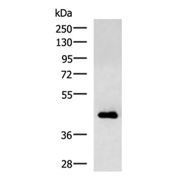 CHI3L1 rabbit polyclonal antibody
