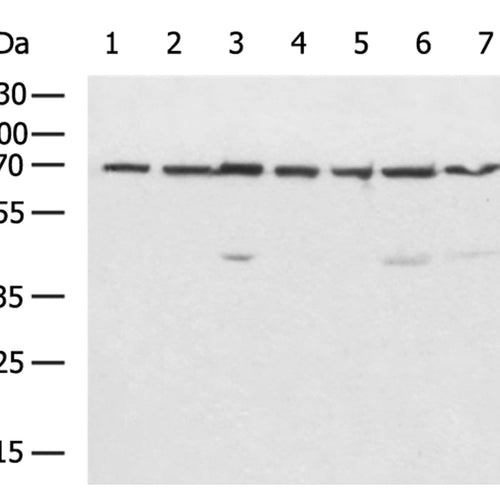 RAF1 rabbit polyclonal antibody