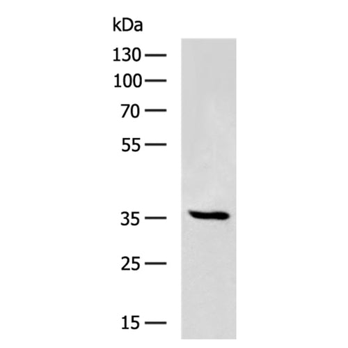 FGL1 rabbit polyclonal antibody