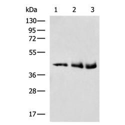 UGCG rabbit polyclonal antibody