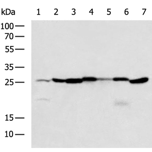 GREM1 rabbit polyclonal antibody