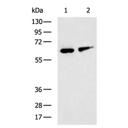 GRK4 rabbit polyclonal antibody
