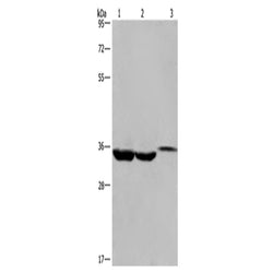 ING2 rabbit polyclonal antibody