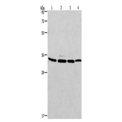 MAD2L1BP rabbit polyclonal antibody