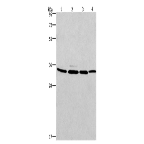 MAD2L1BP rabbit polyclonal antibody
