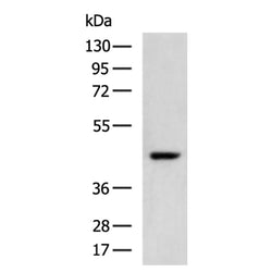 SERPINB5 rabbit polyclonal antibody