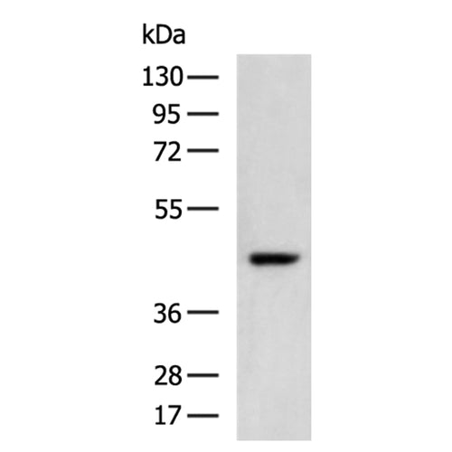 SERPINB5 rabbit polyclonal antibody